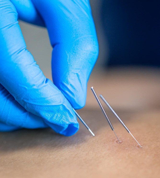 Exosomas ciencia y estética en tu piel ACUPUNTURA Y TERAPIA MOLECULAR